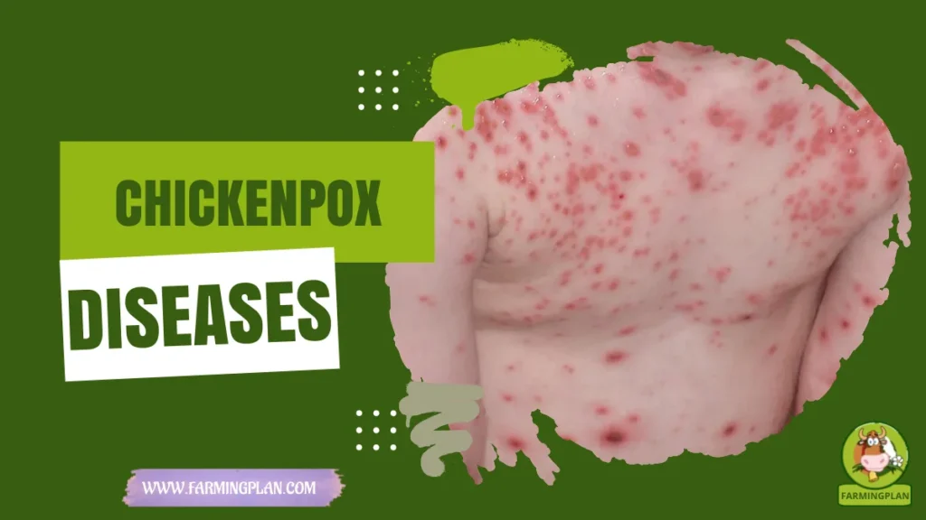 chickenpox